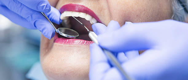 Best Emergency Root Canal Treatment in Bandon, OR